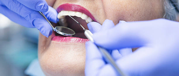 Best Orthodontic Emergency Dentist in South Pasadena, FL